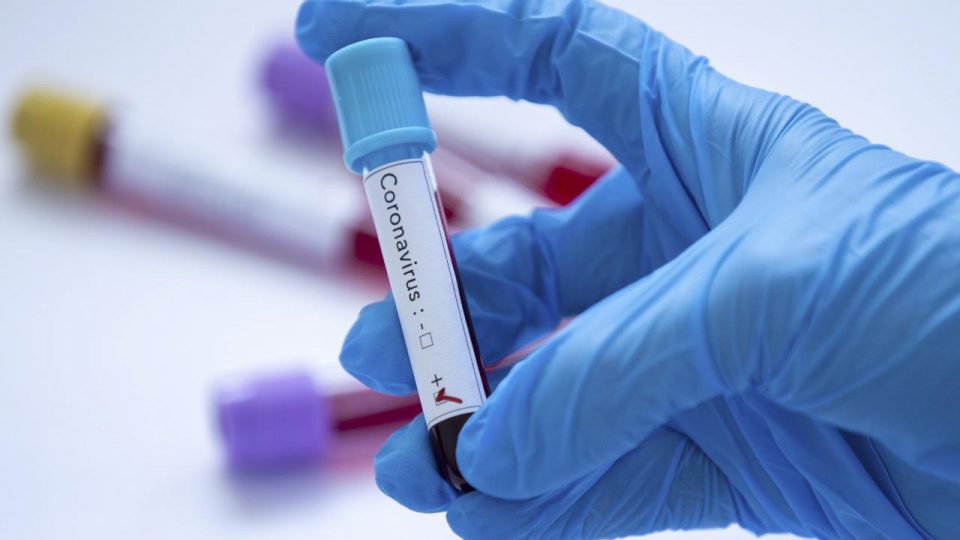 Premier Lig’de koronavirüs vakaları arttı